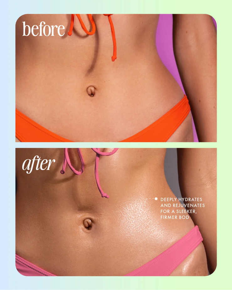before after