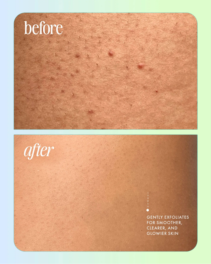 before after